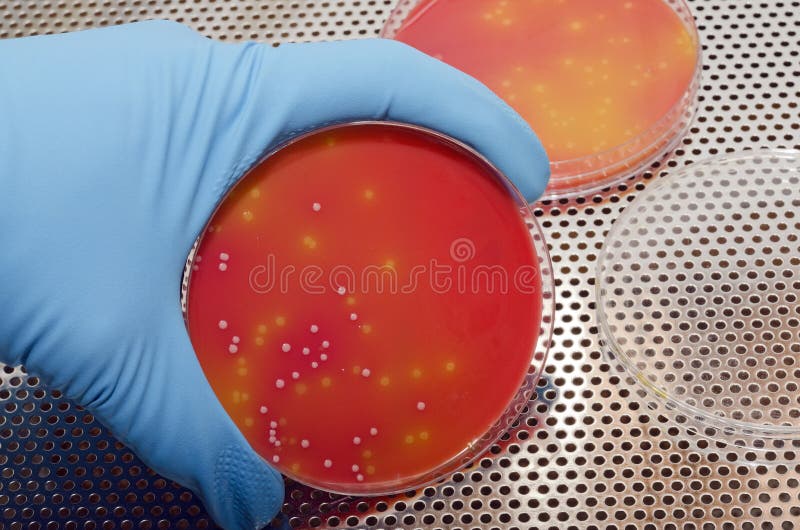 Listeria Petri Dish Stock Photos Free & RoyaltyFree Stock Photos