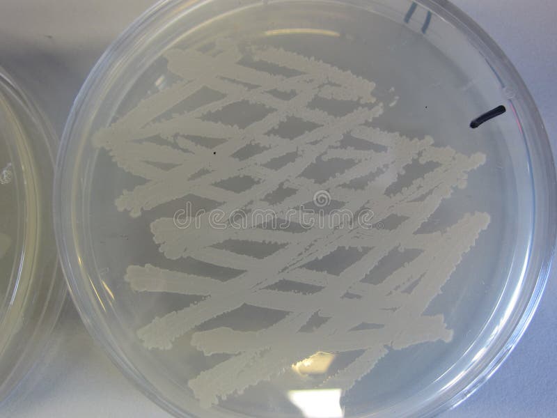 petri dish with bacteria colonies royalty free stock photography petri dish with bacteria colonies royalty free stock photography