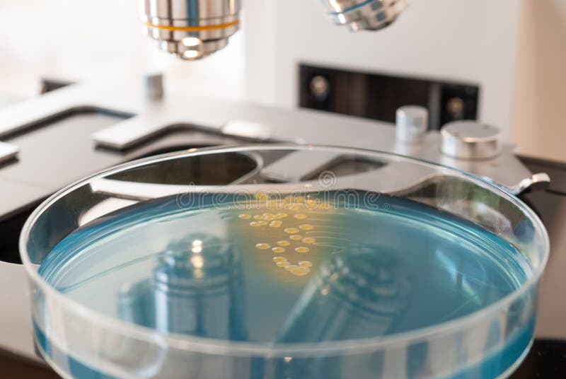 Petri Dish with Bacteria on Laboratory Microscope Stock Image Image