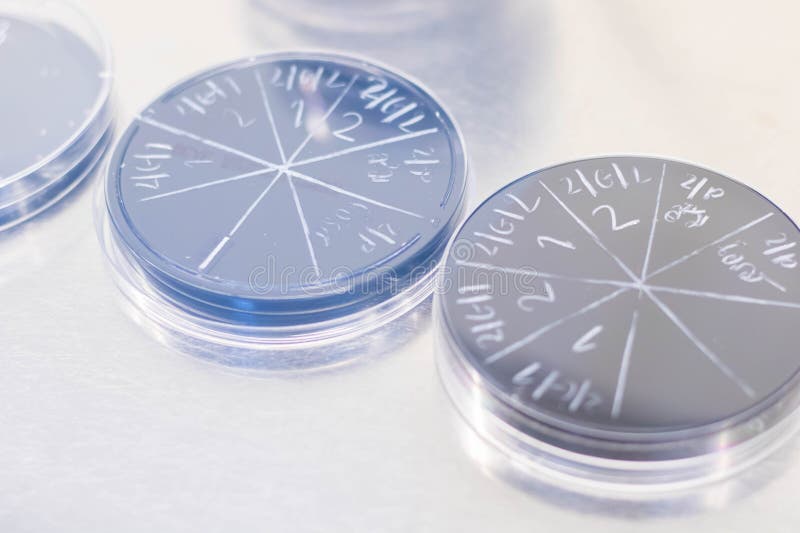 Petri Dish with Bacterial Colonies on Petri Dish in Microbiology