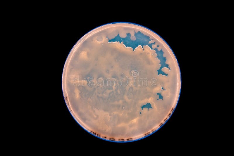 Petri Dish with Colonies of Bacteria in a Microbiology Laboratory Stock Photo Image of science