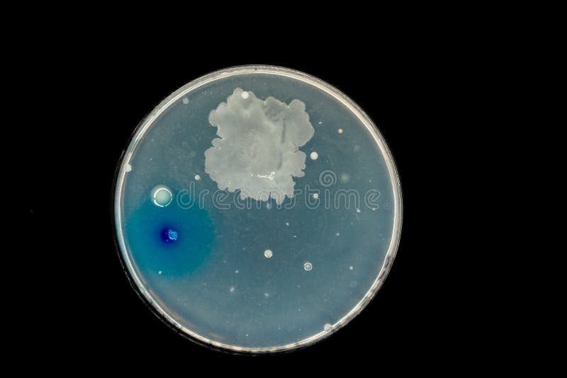 Petri Dish with Colonies of Bacteria in a Microbiology Laboratory Stock Image Image of medical