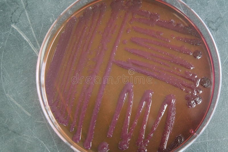 Petri Dish with Various Bacteria Colonies on Agar Stock Photo Image