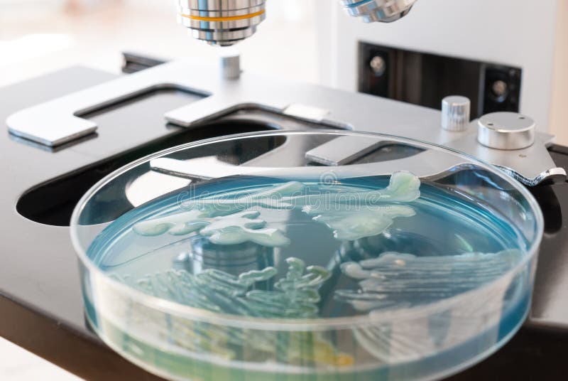 Petri maträtt som smittas med bakterier på laboratoriummikroskopet arkivfoto