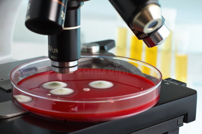 Petri Plate Under in the Laboratory Microscope Stock Photo Image of