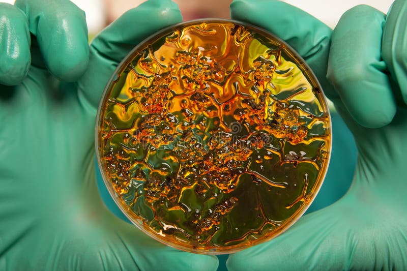 Scientist holding a petri dish with virus cells. Scientist holding a petri dish with virus cells