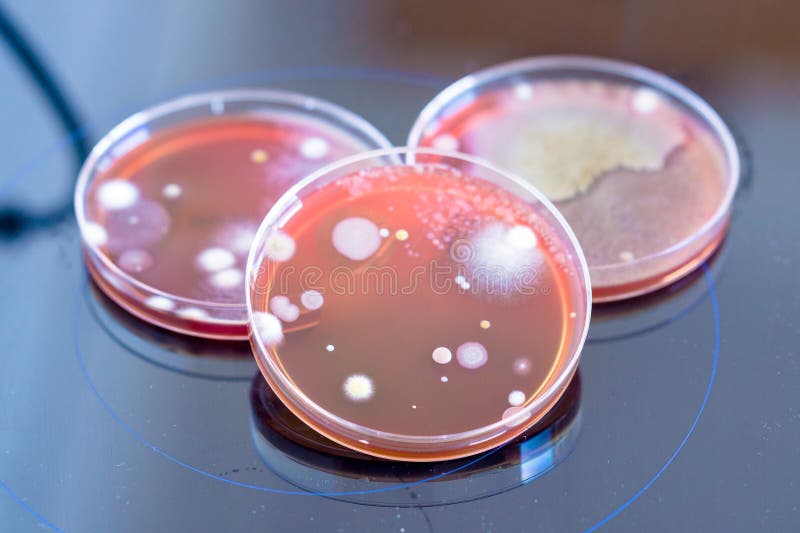 Petriskålar med kolonier av mikroorganismer i ett biologiskt laboratorium