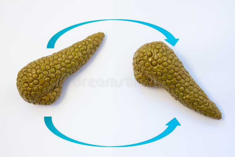 Photo de concept de transplantation de pancréas Deux modèles anatomiques de glande de pancréas avec deux flèches croisant au-dess image libre de droits Photo de concept de transplantation de pancréas Deux modèles anatomiques de glande de pancréas avec deux flèches croisant au-dess image libre de droits