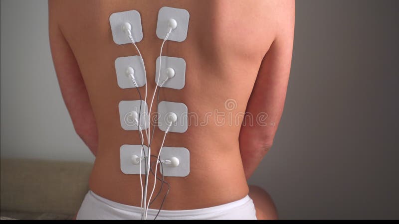 Lower Back Physical Therapy with TENS Electrode Pads, Transcutaneous  Electrical Nerve Stimulation Stock Image - Image of electric, electro:  210760669