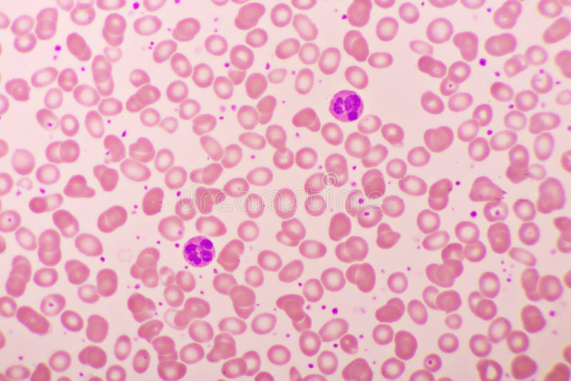 Picture of blood cell in blood smear