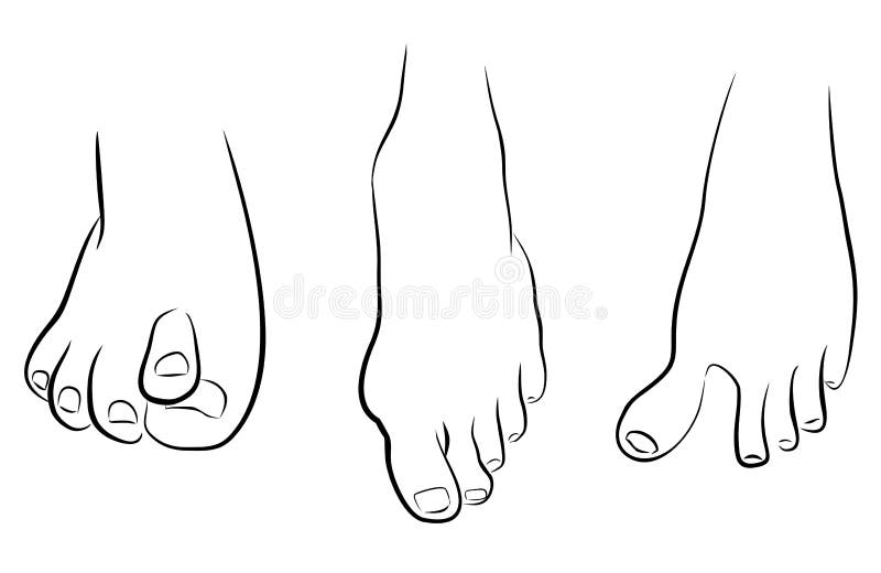 Piedi anormali illustrazione vettoriale Piedi anormali illustrazione vettoriale