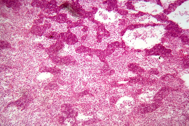 A section trough lymph node cells under the microscope. A section trough lymph node cells under the microscope.