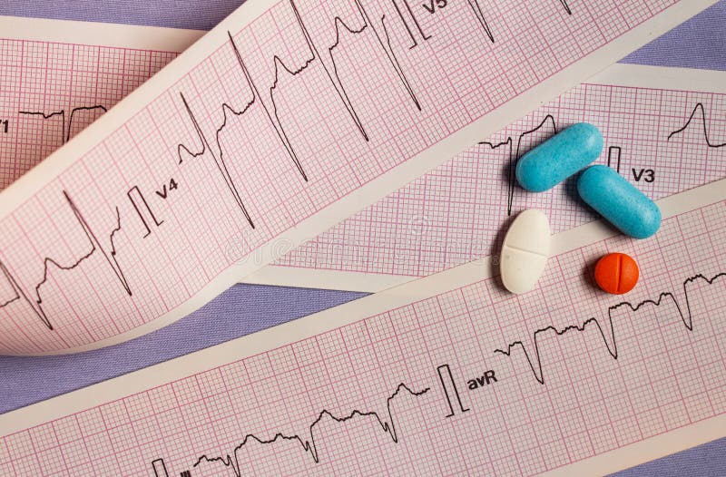 Pilules colorées sur des bandes des électrocardiogrammes photographie stock libre de droits Pilules colorées sur des bandes des électrocardiogrammes photographie stock libre de droits