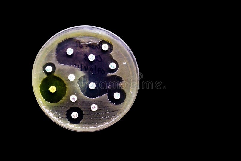 Placa de cultura del crecimiento bacteriano que muestra sensibilidad antibiótico en su modelo de la colonia aislado en fondo negr