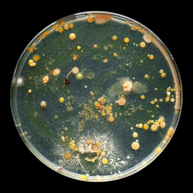 Placa de Petri con las bacterias aisladas en negro