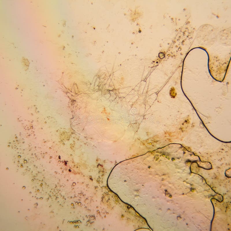 Plancton ed alghe freschi dell'acqua dello stagno al microscopio Copepoda. Plancton ed alghe freschi dell'acqua dello stagno al microscopio Dettagli morti della copepoda
