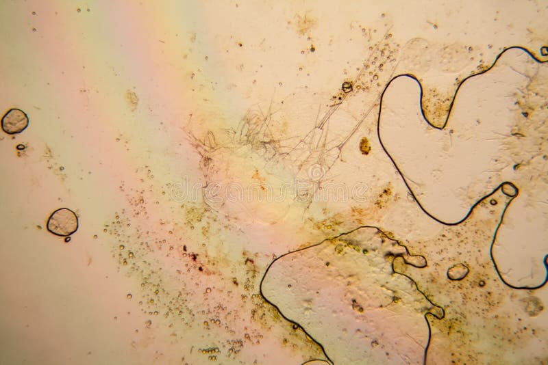 Plancton ed alghe freschi dell'acqua dello stagno al microscopio Copepoda fotografia stock