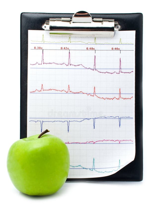 Plane-table with a cardiogram and apple