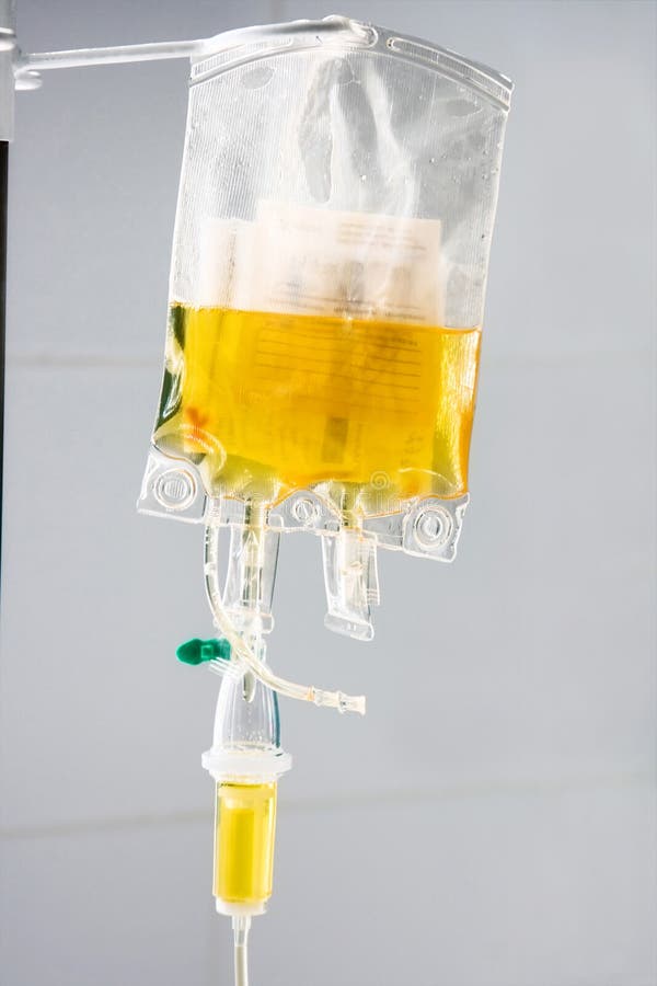 Transfusion Des Menschlichen Plasmas Im Krankenhaus Stockfoto Bild