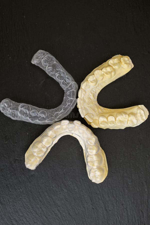 Plaster Cast of Teeth. Future Implants Stock Image Image of plaster