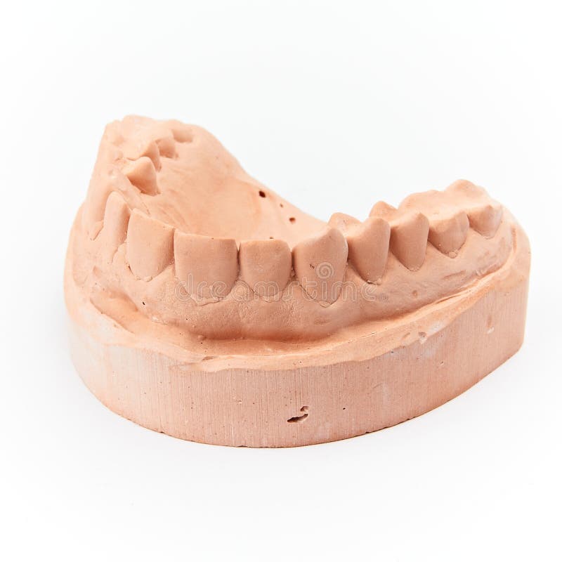 Plaster dental mold stock photo. Image of frontal, human 25337494