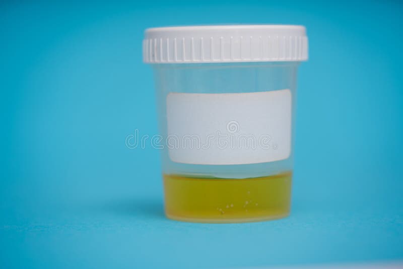 Plastic Containers for Taking Medical Tests Stock Image Image of