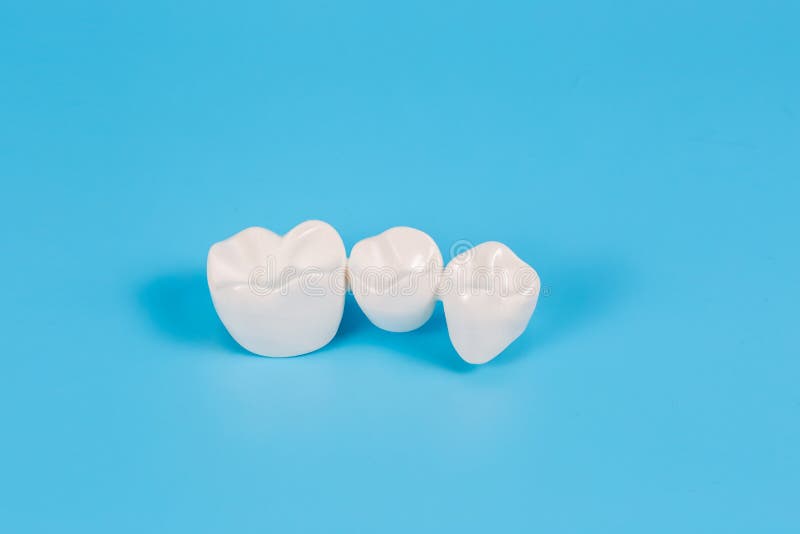 Plastic Dental Crowns, Imitation of a Dental Prosthesis of a Dental Bridge Stock Image Image