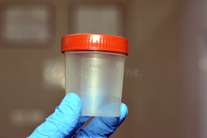 A Plastic Urine Test Container for Laboratory Analysis Urinalysis, a