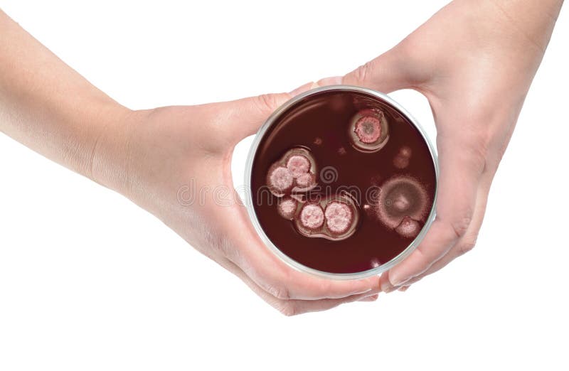 Plato del control de las manos limpias que contiene a colonias bacterianas