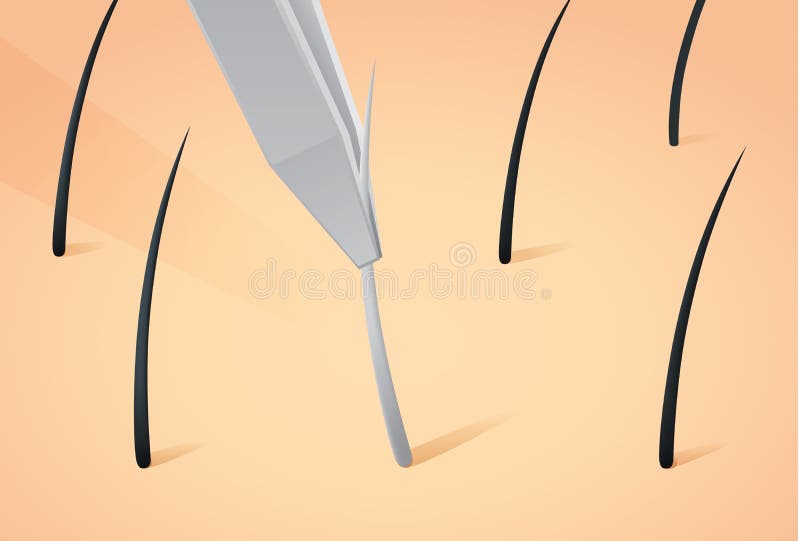 Plucking Gray Hair from Head with Tweezers. Stock Vector - Illustration of damage, pigment: 74435544 Plucking Gray Hair from Head with Tweezers. Stock Vector - Illustration of damage, pigment: 74435544