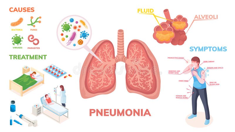 Image result for 10 Signs of Walking Pneumonia infographics