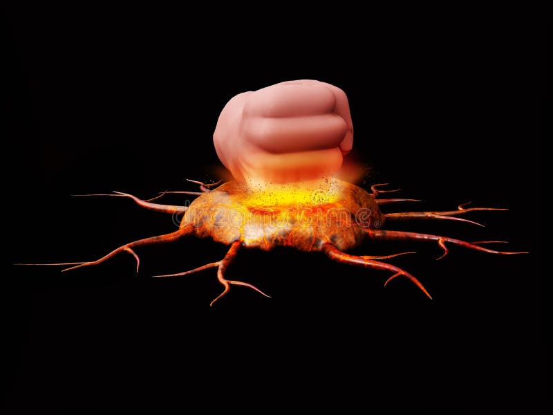 Pojęcie jako ciężki pięści miażdżenie niszcząca komórek nowotworowych 3d ilustracja i obraz royalty free Pojęcie jako ciężki pięści miażdżenie niszcząca komórek nowotworowych 3d ilustracja i obraz royalty free