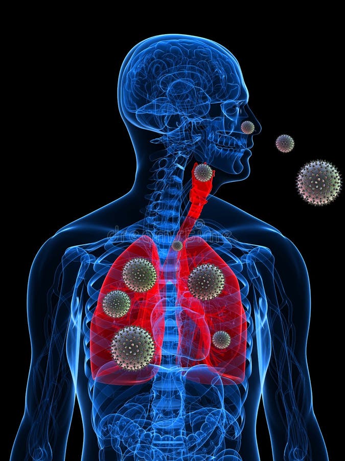 Pollen allergy illustration