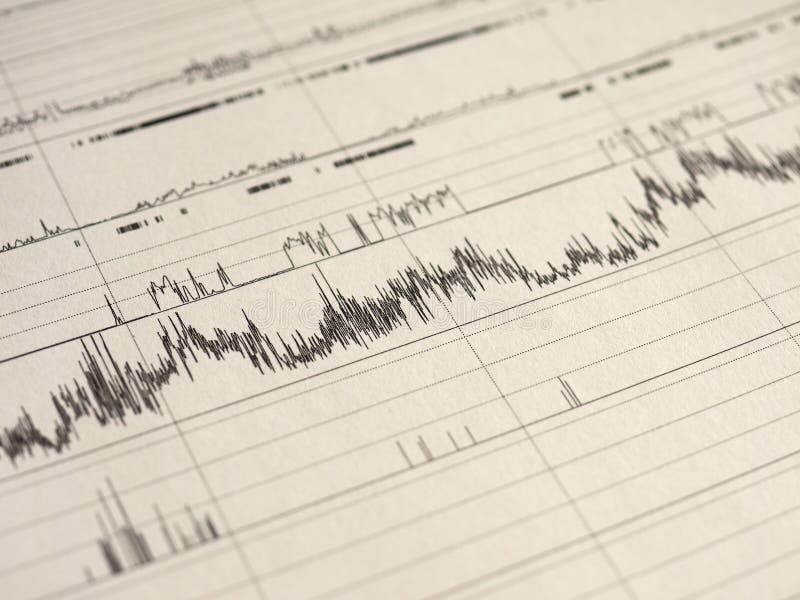 Polysomnography Psg睡眠研究库存照片 图片包括有图形 休眠 参数 关心 研究 9100
