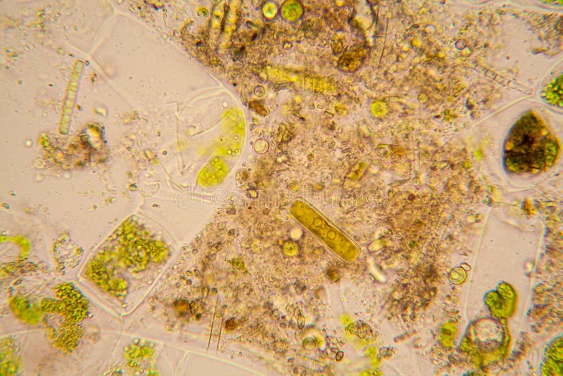 Cloroplastos al microscopio