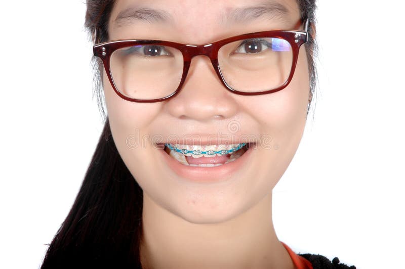 Portrait of asian young girl with glasses and braces