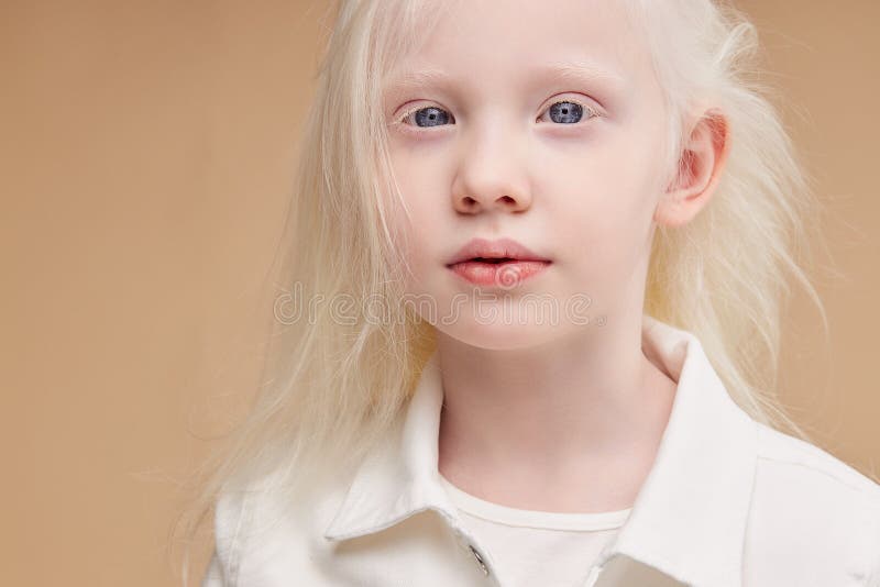 22,994 Albino Stock Photos - Free & Royalty-Free Stock Photos from  Dreamstime