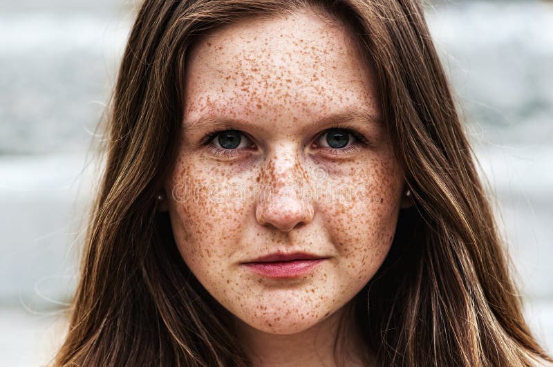 Freckle Covered Naked Girls