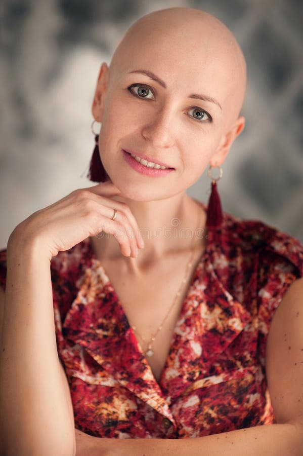 Portrait Of Beautiful Middle Woman Patient With Cancer With Shaved Head