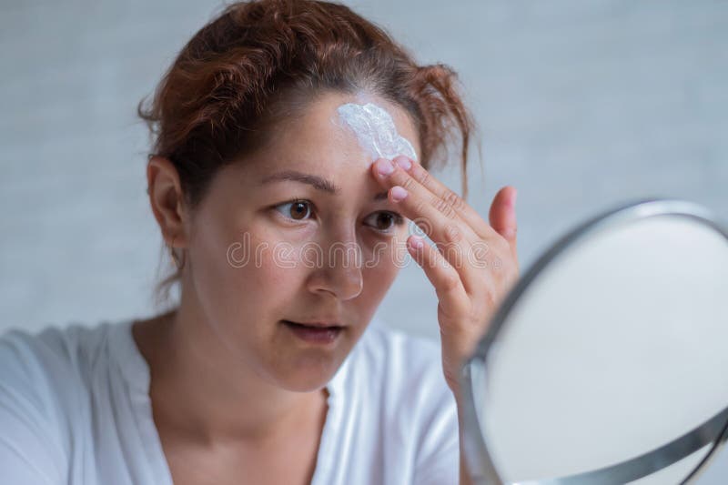 Portrait of a Caucasian woman with vitiligo disease uses sunscreen. A girl with a white pigment spot on her forehead