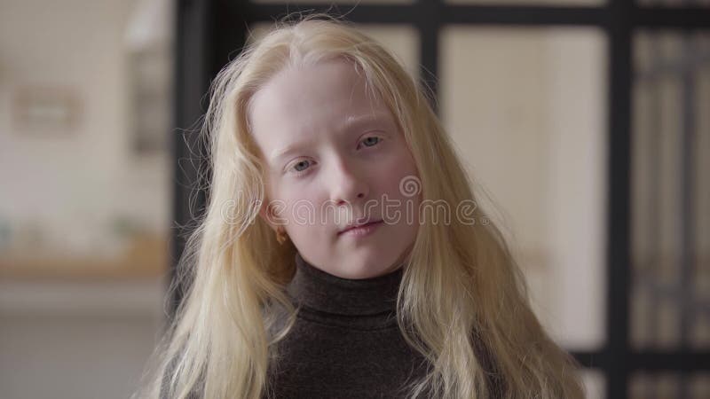 Portrait d'une fille albinos avec les yeux gris regardant le sourire de caméra Aspect peu commun Enfance insouciant Visage de