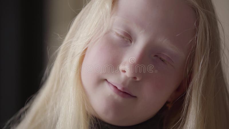Portrait haut étroit d'une fille albinos avec les yeux gris regardant le sourire de caméra Aspect peu commun Enfance insouciant