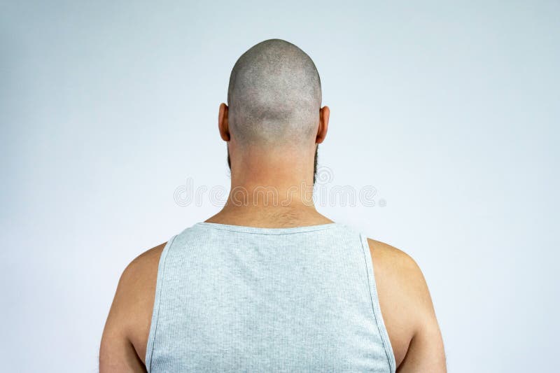 428 Bald Head Back View Photos Free Royalty Free Stock Photos From Dreamstime 428 Bald Head Back View Photos Free Royalty Free Stock Photos From Dreamstime