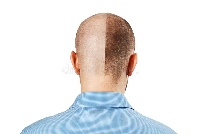 Back Man Head Hair Cut Isolated Stock Photos - Free & Royalty-Free Stock  Photos from Dreamstime