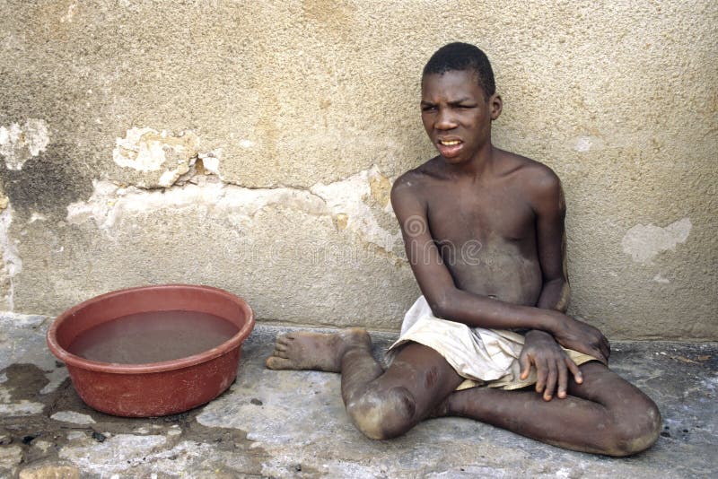 Portrait of mentally disabled Ugandan boy