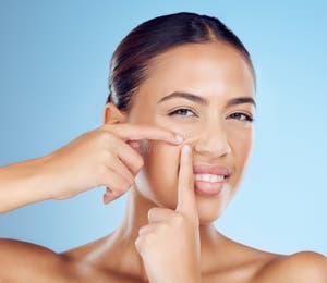 Portrait Pimple And Woman In Studio For Acne Treatment And Cosmetic Portrait Pimple And Woman In Studio For Acne Treatment And Cosmetic