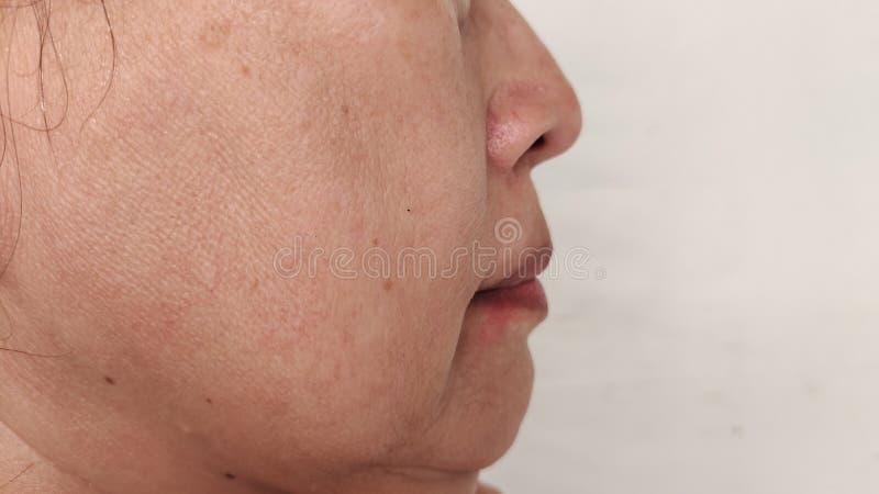 Portrait showing the Freckles and blemish, adipose sagging on the cheek, dark spots and loss, problem wrinkle and dullness on the face of the woman, concept health care. Problem wrinkle stock images, royalty-free photos and pictures