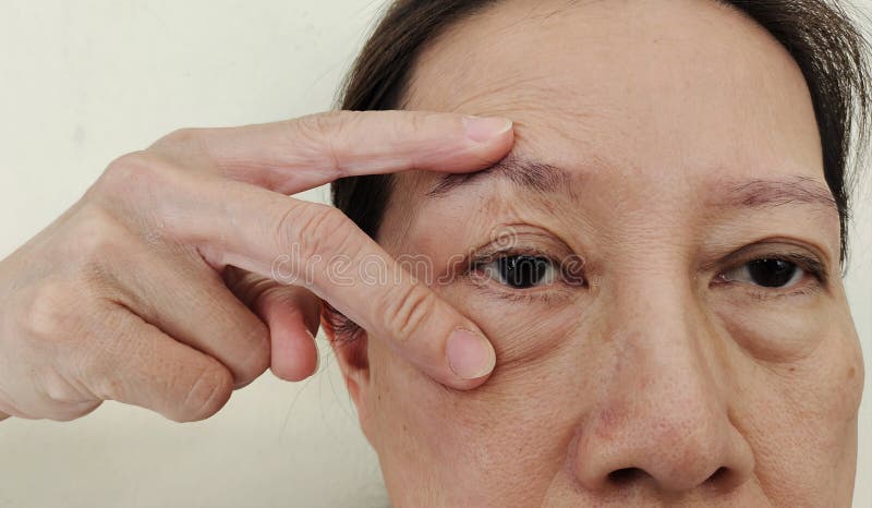 Portrait showing the Freckles and blemish, adipose sagging beside the cheek, ptosis and flabby skin beside the eyelid, problem wrinkle and dull skin on the face of the woman, health care and beauty concept. Problem wrinkle stock images, royalty-free photos and pictures