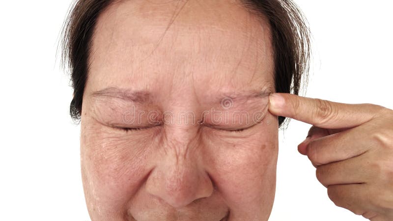 Portrait showing the Freckles and blemish, dark spots and loose, ptosis and swelling, flabby skin beside the eyelid, problem wrinkle and dullness on the face of the woman, health care and beauty concept. Problem wrinkle stock images, royalty-free photos and pictures