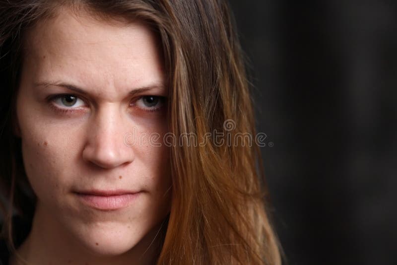 Portrait of Young White Woman Stock Photo Image of lentigo, skin